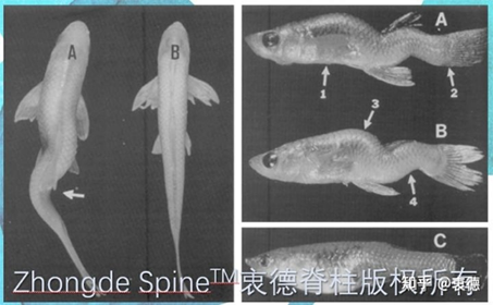 7. Only humans have scoliosis, while other terrestrial vertebrates do not have scoliosis