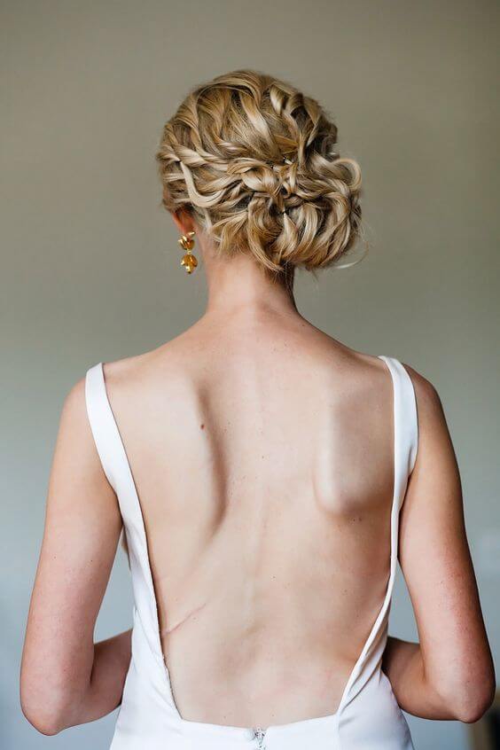 What is scoliosis?