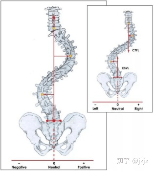 Sacral midline CSVL and C7VL neck 7 plumb line distance