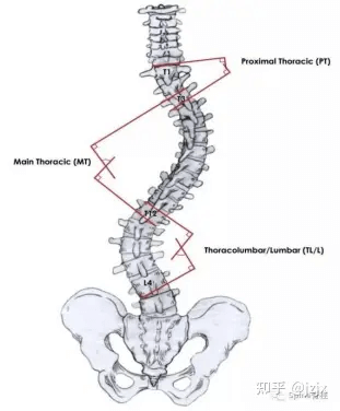 Cobb angle of scoliosis