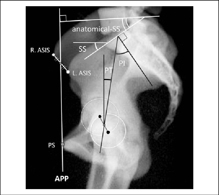 PI Pelvic Index