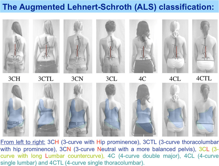 3C, 4C spiral quantity correction+N, TL, L bending part correction