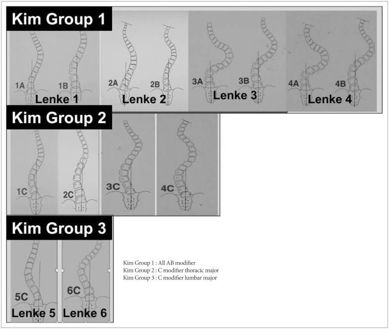 A. B, C, E bending types+1, 2, 3 pelvic tilt correction